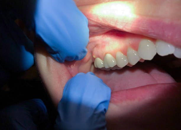 Best Pediatric Emergency Dentist in St Bonifacius, MN